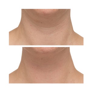 StriVectin TL Advanced Tightening Neck Cream Plus, 1 oz, 2-pack