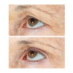 Strivectin Peptight Tightening Eye Serum, 0.65 fl oz, 2-pack