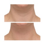 StriVectin TL Advanced Tightening Neck Cream Plus, 1 oz, 2-pack